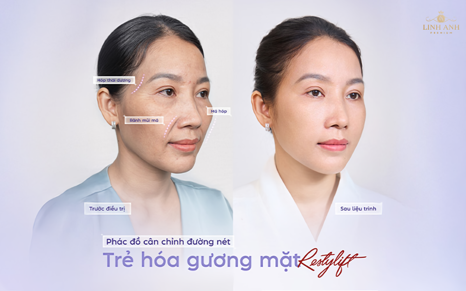 PHẪU THUẬT HAY THẨM MỸ NỘI KHOA: LỰA CHỌN NÀO CHO VẺ ĐẸP TỰ NHIÊN?